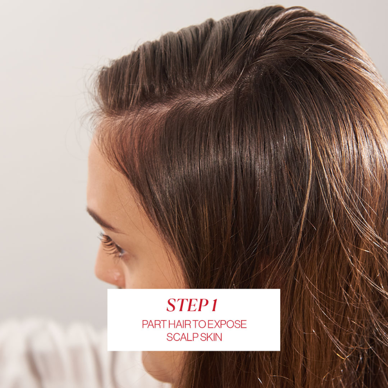 calecim-advanced-hair-system-kit-1-paso