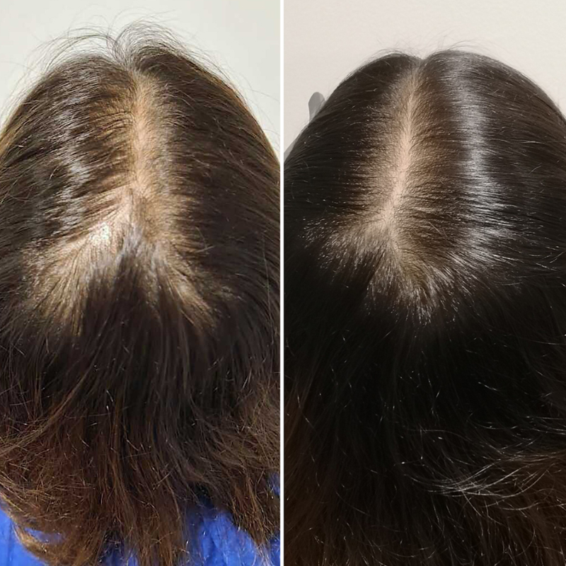 kit-calecim-advanced-hair-system