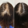 kit-calecim-advanced-hair-system