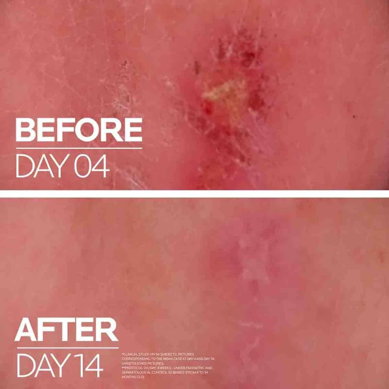 la-roche-posay-ciclapast-baume-b5