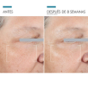 resultados-crema-contorno-de-ojos-skinceuticals-age-advanced-eye