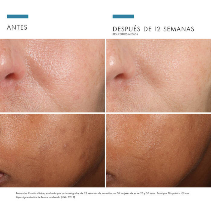 skinceuticals-phloretin-cf-serum-resultados