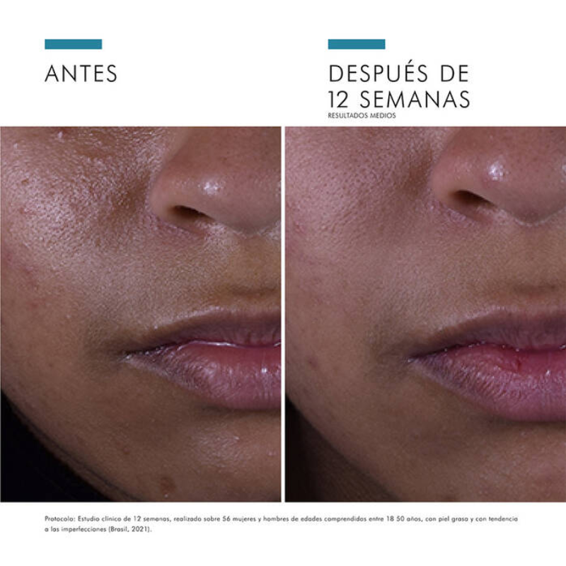 skinceuticals-silymarin-cf-beneficios