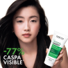 vichy-dercos-acondicionador-anticaspa-hair-scalp-beneficios